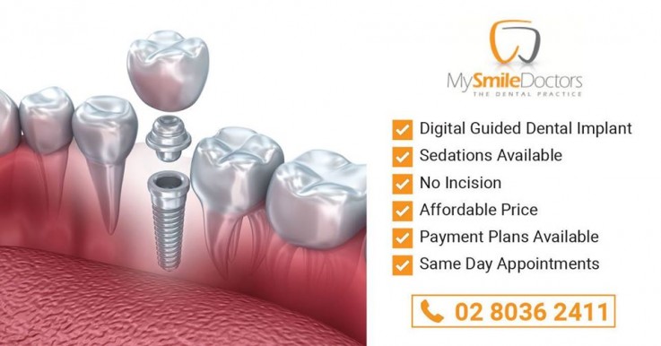 Say Goodbye to your dental problems with help from Mysmiledoctors